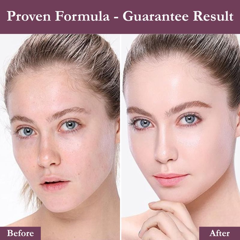 LumiLift™ – Korean Pro Treatment Now at Home