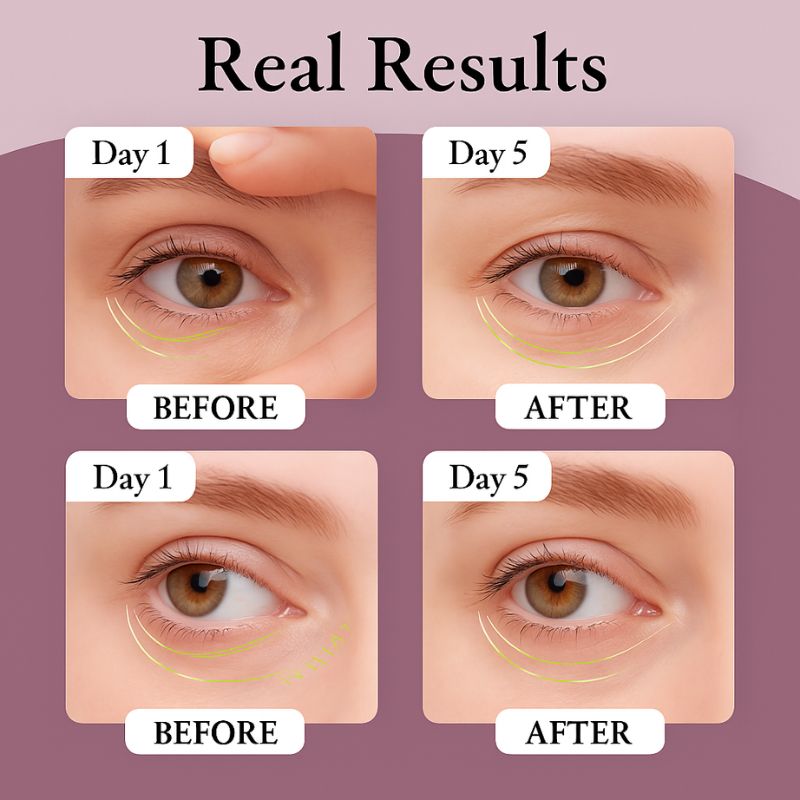 Freeze-Dried Collagen Eye Patches With Peptides
