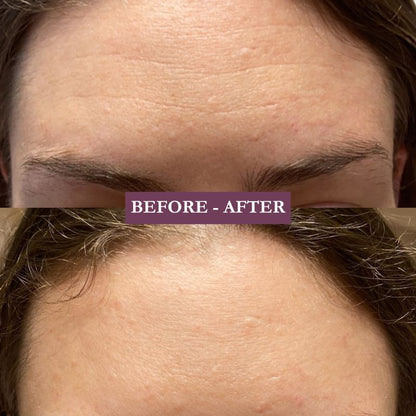 Savinora - Botox-like cream 30ml