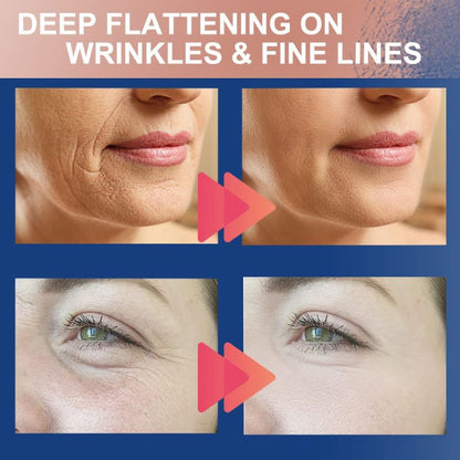 Medical Anti-Wrinkle Tape