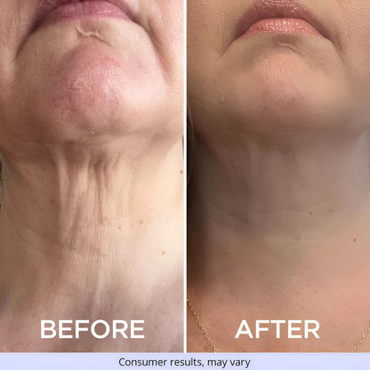 Tighten and lift Neck Cream