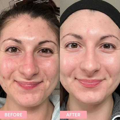 Primer Pore Minimizer - 22ml